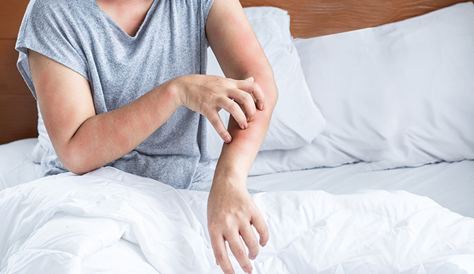 A person scratching a red, inflamed skin rash on their forearm.